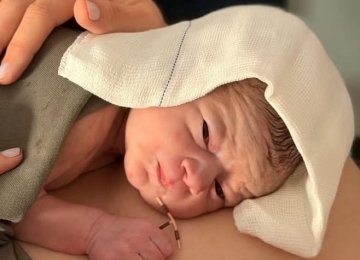 Bebê nasce com DIU colado à placenta no Paraná e caso chama atenção