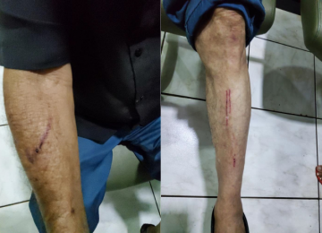 Fumaça de churrasqueira resulta em episódio de agressão a idoso no Jardim Goiás
