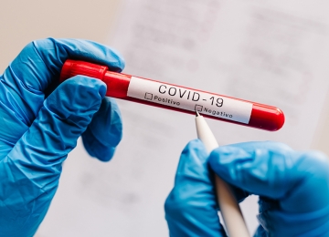 Cientistas brasileiros investigam pessoas imunes à Covid-19
