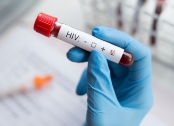 4º caso de cura do HIV foi anunciado nos EUA