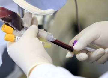 Anvisa recomenda que infectados por varíola dos macacos aguardem 21 dias para doar sangue