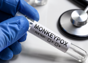 ANS determina que planos de saúde cubram teste para varíola dos macacos