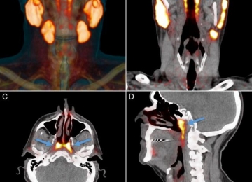 Novo órgão no centro da cabeça humana pode ter sido descoberto por cientistas