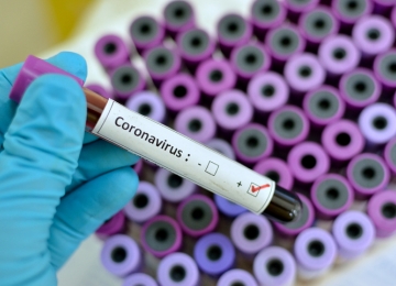 Brasil possui mais de 70 casos confirmados de coronavírus