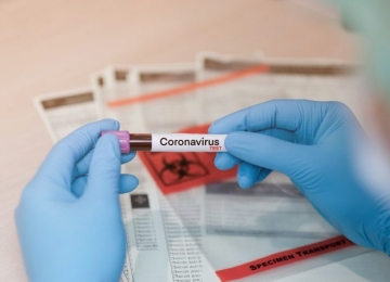 Coronavírus no sudoeste goiano: atualização de Santa Helena, Jataí e Caçu