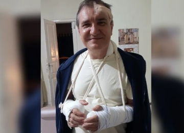 Ex-candidato a governador de Goiás, Wolmir Amado deve passar por cirurgias após quebrar os dois braços em queda