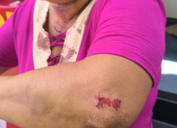 Homem agride mãe e tenta matar padrasto a facadas no Gameleira II
