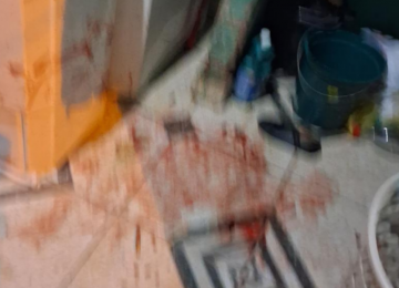 Filho enfrenta padrasto agressor para defender a mãe durante ataque no bairro Martins