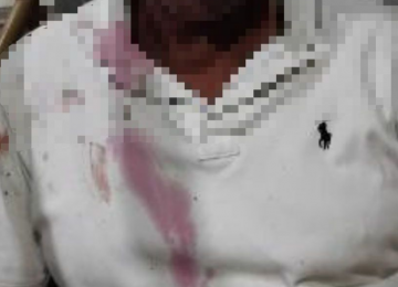 Discussão por celular em festa termina em agressão e atuação da GCM no Portal dos Ipês