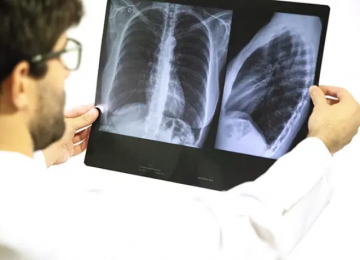 Goiás decreta emergência em saúde após alta de casos de síndrome respiratória grave