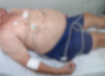 Homem é atacado com arma branca dentro de bar na Vila Santa Cruz, em Rio Verde