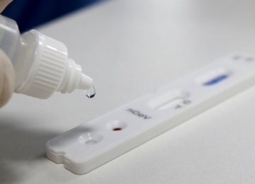 Hospitais estaduais goianos oferecem testes rápidos de Covid-19