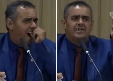 Vídeo de vereador de Goianésia tirando a dentadura viraliza, entenda