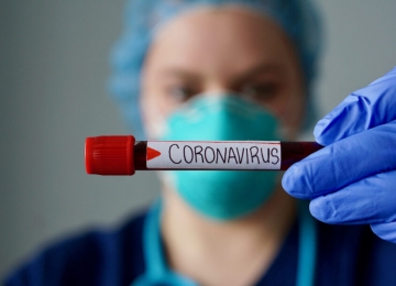 Goiás chega a 1.024 infectados pelo coronavírus com 45 mortes confirmadas