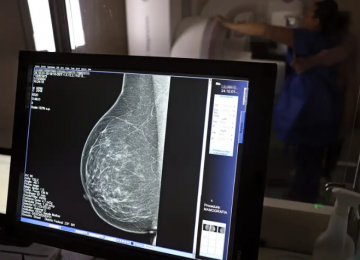 Ministério da Saúde passa a recomendar mamografia a partir dos 40 anos