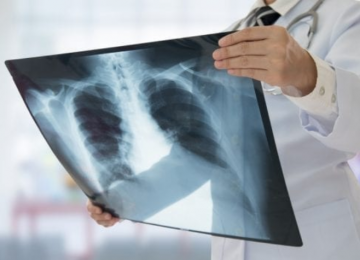 Medicamento brasileiro pode regenerar medula espinhal e desperta atenção mundial