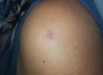 Mulher é agredida com socos e sofre tentativa de estrangulamento pelo companheiro no Bairro Martins em Rio Verde