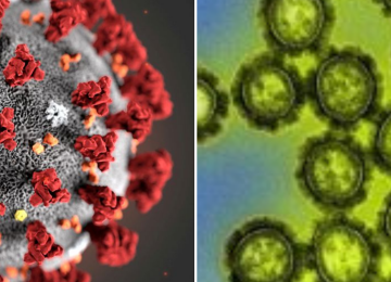 Brasil pode ter o 1º caso de infecção mista por Influenza e Covid-19