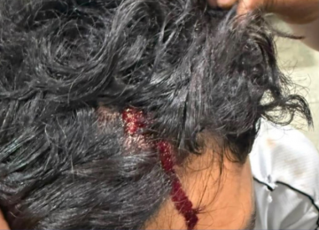 Mulher é presa suspeita de invadir casa e agredir ex-namorado após fim do relacionamento em Rio Verde
