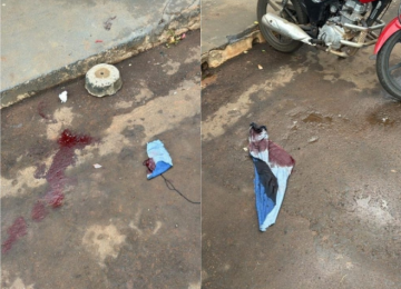 Pedestre é atacado por cães da raça pitbull no Conjunto Valdeci Pires