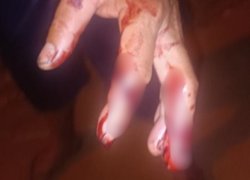 PM prende suspeito após ataque a casal, incluindo gestante, no bairro Martins, em Rio Verde