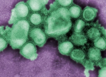 Saúde de Rio Verde emite comunicado sobre Gripe Influenza