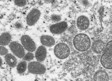 SES-GO emite nota reforçando medidas de prevenção contra a varíola dos macacos