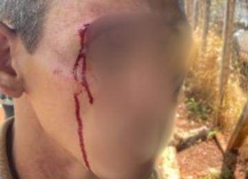 GCM Motos intervém em caso de agressão e desacato em feira livre na Vila Amália