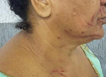 Polícia Militar conduz mulheres à delegacia após briga familiar em Rio Verde