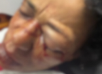 Homem é preso por agredir esposa no Jardim Goiás; vítima apresentava ferimentos graves