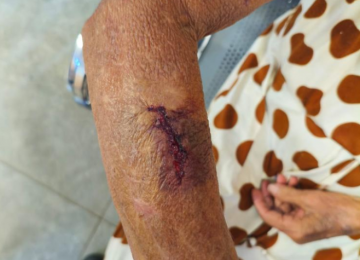 PM prende mulher após agredir filhos e ferir a própria avó, de 90 anos, com faca no Setor Pauzanes