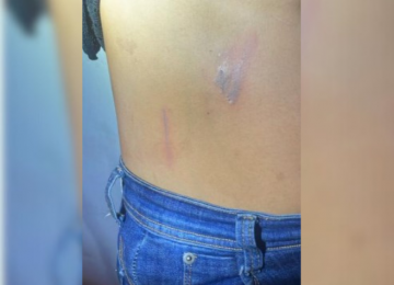 Mulher foge após ser estuprada e agredida; polícia prende suspeito em Rio Verde