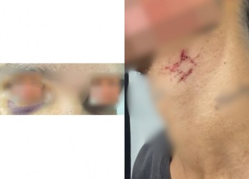 Polícia Civil resgata homem mantido como escravo sexual e desarticula esquema de tráfico internacional em Goiânia