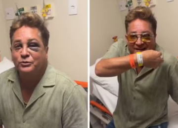 Leonardo vai ao hospital após acidente em canoa e tranquiliza fãs