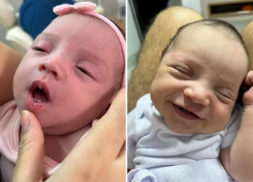 Bebê nasce com dois dentes e surpreende família em Rio Verde