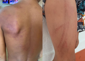 Polícia Civil prende pai suspeito de agredir filho de 6 anos em Rio Verde