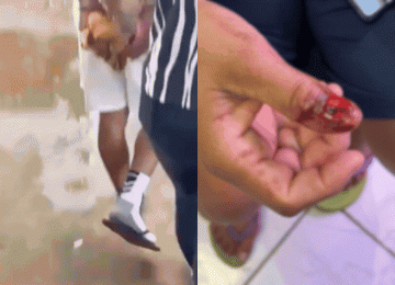 Homem é preso após morder e arrancar unha da companheira durante ataque em Rio Verde