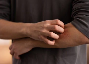 Após surto de coceira, colégio militar de Goiás investiga possível uso de pó de mico