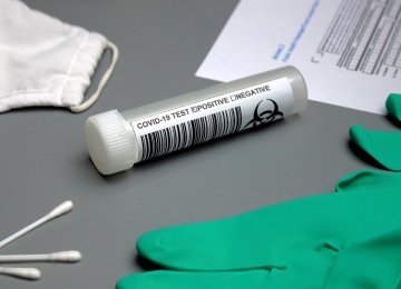Ministério da Saúde distribuirá 28,2 milhões testes para Covid neste mês de janeiro