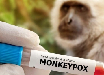 Foi confirmada primeira morte por varíola dos macacos 