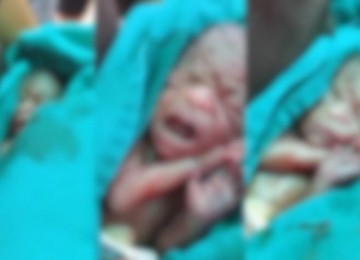 Esperança interrompida: bebê prematuro dado como morto volta a respirar, mas não sobrevive