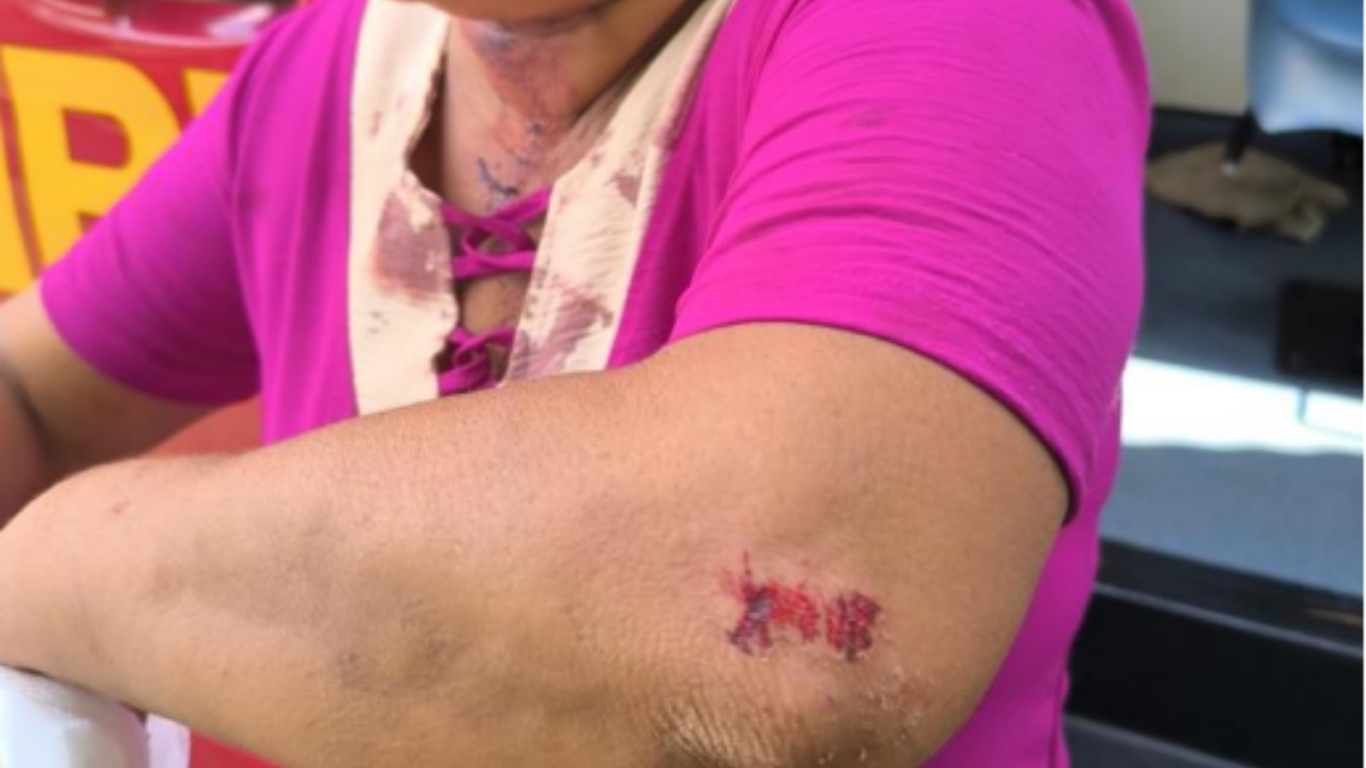 Homem agride mãe e tenta matar padrasto a facadas no Gameleira II