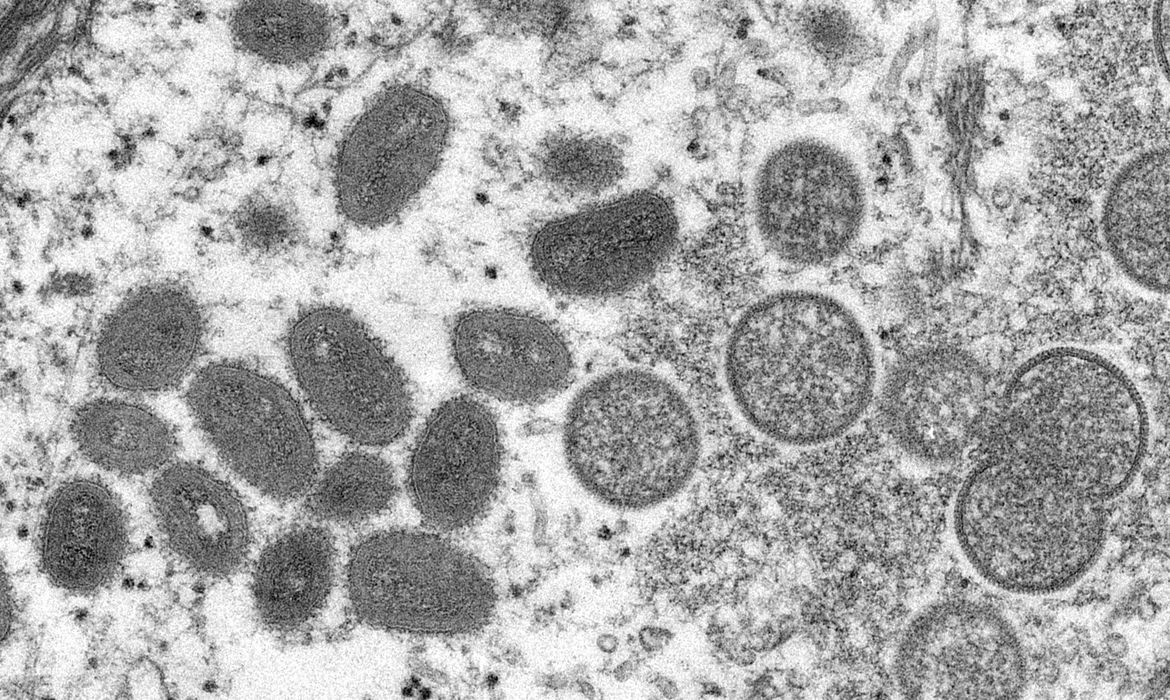 Ministério da Saúde cria sala para monitoração da varíola dos macacos no Brasil