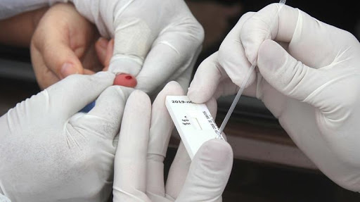 Farmácias devem cumprir critérios rigorosos para aplicar testes rápidos