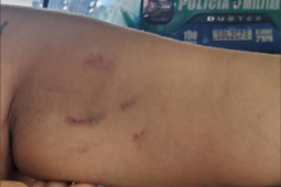 Discussão por aluguel termina em briga, ameaças e duas mulheres na delegacia em Rio Verde