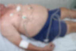 Homem é atacado com arma branca dentro de bar na Vila Santa Cruz, em Rio Verde