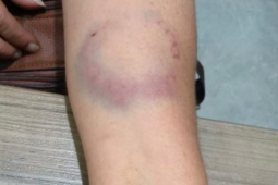 Homem é preso após agredir companheira com tapas, chutes e mordida em Rio Verde