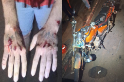 Motorista embriagado foge de acidente após ferir motociclista em colisão no Residencial Veneza