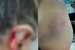 Neto é preso após arrancar pedaços da orelha da avó a mordidas e confessar que engoliu partes do corpo