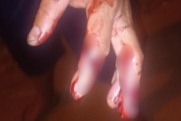 PM prende suspeito após ataque a casal, incluindo gestante, no bairro Martins, em Rio Verde